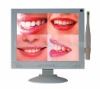 Endoscope