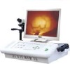 breast thermography