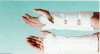 Waist support beyond the forearm