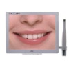 dental camera