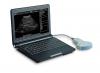 SW-1200A Laptop ultrasound scanner
