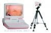 SW-3303 Digital Electronic Colposcope (Portable type)